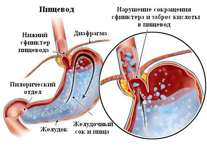 прищевод пищевод
