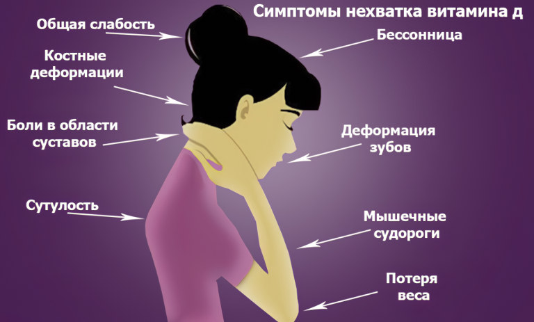 Симптомы недостатка витамина Д Симптомы недостатка витамина Д