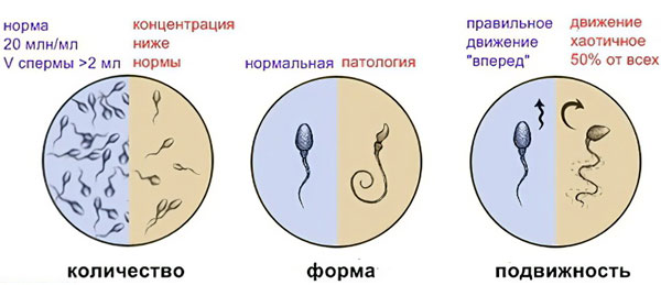 Спермограмма