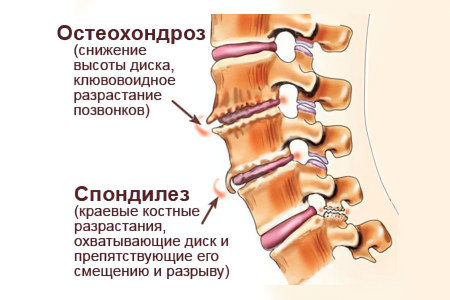 Нарушение обменных процессов