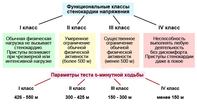 Стабильная стенокардия