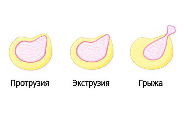 Стадии формирования