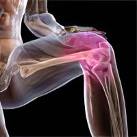 Повреждение медиального мениска коленного сустава: диагностика, лечение