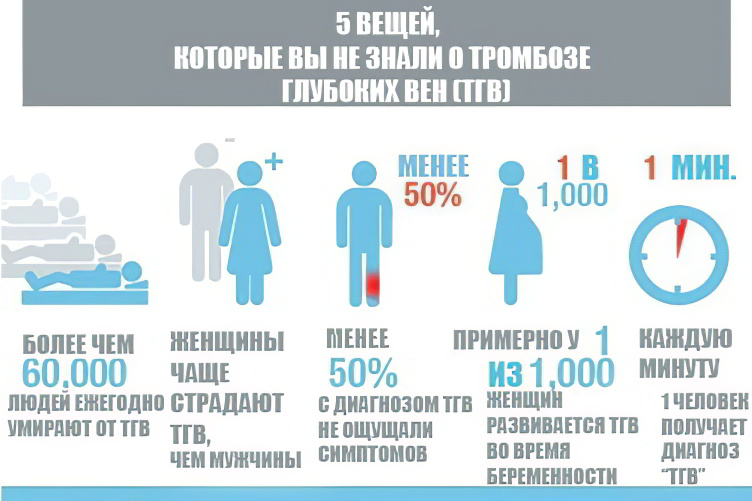 Тромбоз глубоких вен