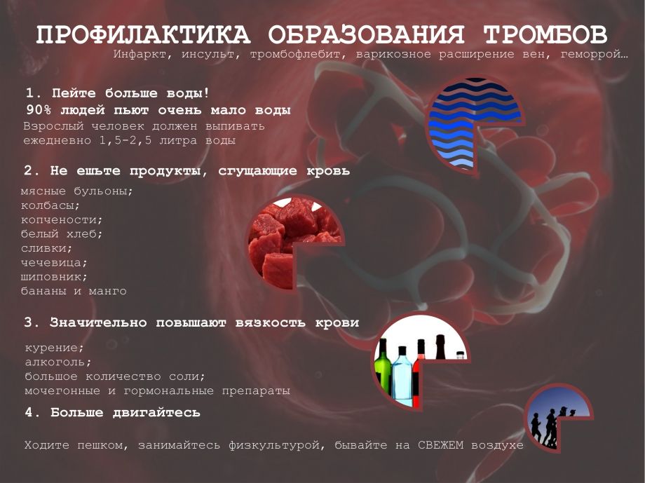 Симптом хоманса и мозеса что это. Смотреть фото Симптом хоманса и мозеса что это. Смотреть картинку Симптом хоманса и мозеса что это. Картинка про Симптом хоманса и мозеса что это. Фото Симптом хоманса и мозеса что это