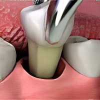 Что делать при отеках зубной боли
