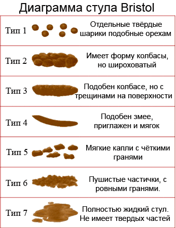 Виды запоров