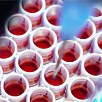 ГГТ в биохимическом анализе крови
