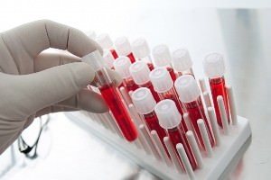 Если уровень эозинофилов ниже нормы Если уровень эозинофилов ниже нормы